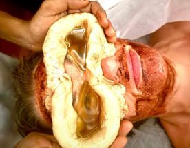 Панчакарма Тур В Индии, На Берегу Океана