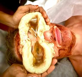 Панчакарма Тур В Индии, На Берегу Океана